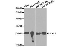 Western Blotting (WB) image for anti-Ubiquitin Carboxyl-terminal Esterase L1 (Ubiquitin Thiolesterase) (UCHL1) antibody (ABIN1875266) (UCHL1 抗体)