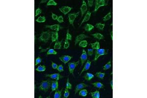 Immunofluorescence (IF) image for anti-Tyrosine-Protein Phosphatase Non-Receptor Type 22 (PTPN22) (AA 1-90) antibody (ABIN1513449)