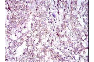 Immunohistochemistry (IHC) image for anti-Sequestosome 1 (SQSTM1) (AA 232-356) antibody (ABIN1846090) (SQSTM1 抗体  (AA 232-356))