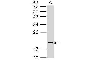 WB Image Sample (30 ug of whole cell lysate) A: Raji 12% SDS PAGE antibody diluted at 1:1000 (RGS13 抗体)