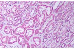 Immunohistochemistry (IHC) image for anti-Tumor Necrosis Factor Receptor Superfamily, Member 1B (TNFRSF1B) antibody (ABIN1104727)