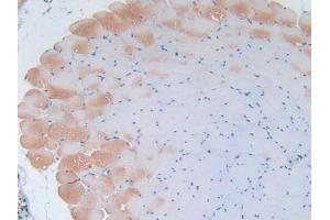 IHC-P analysis of Mouse Skeletal Muscle Tissue, with DAB staining. (IL-2 抗体  (AA 10-169))