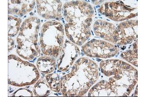 Immunohistochemical staining of paraffin-embedded Human Kidney tissue using anti-TTC32 mouse monoclonal antibody. (TTC32 抗体)