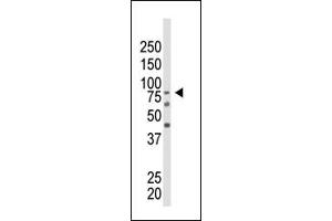 The anti-EZH2 Ctr Pab (ABIN6244310 and ABIN6578917) is used in Western blot to detect EZH2 in mouse kidney tissue lysate. (EZH2 抗体  (AA 410-440))