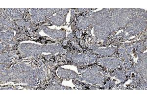 IHC analysis of L/CMBL using anti-L/CMBL antibody (ABIN7599150).