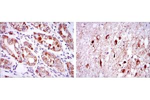 Immunohistochemical analysis of paraffin-embedded stomach tissues (left) and brain tissues (right) using OTX2 mouse mAb with DAB staining. (OTX2 抗体)