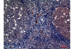 Immunohistochemistry (IHC) analysis of paraffin-embedded Human Tonsils, antibody was diluted at 1:100. (P-Selectin 抗体  (Internal Region))
