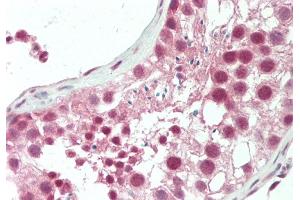 Rabbit Anti-HERC5 antibody  Formalin Fixed Paraffin Embedded Tissue: Human Testis Primary antibody Concentration: 1:100 Secondary Antibody: Donkey anti-Rabbit-Cy3 Secondary Antibody Concentration: 1:200 Magnification: 20x Exposure Time: 0. (HERC5 抗体  (N-Term))