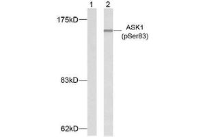 Western blot analysis of extracts from K562 cells using ASK1 (phospho-Ser83) antibody (E011178). (ASK1 抗体  (pSer83))