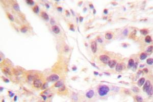 Image no. 1 for anti-V-Ets erythroblastosis Virus E26 Oncogene Homolog 1 (Avian) (ETS1) antibody (ABIN272023) (ETS1 抗体)