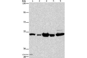 Western blot analysis of Human bladder carcinoma and brain malignant glioma tissue, A172 cell, human fetal brain tissue and hela cell, using PDE4D Polyclonal Antibody at dilution of 1:450 (PDE4D 抗体)