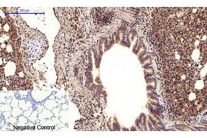 Immunohistochemical analysis of paraffin-embedded rat lung tissue. (Cadherin 5 抗体  (Internal Region))