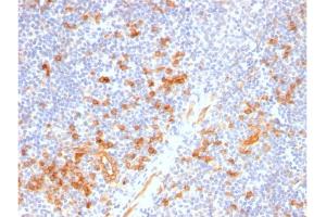 Formalin-fixed, paraffin-embedded human Tonsil stained with IL3RA / CD123 Rabbit Recombinant Monoclonal Antibody (IL3RA/2947R). (Recombinant IL3RA 抗体  (AA 26-171))