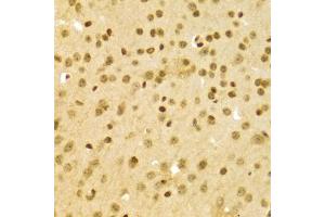 Immunohistochemistry of paraffin-embedded mouse brain using DKC1 Antibody (ABIN5970956) at dilution of 1/100 (40x lens). (DKC1 抗体)