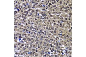 Immunohistochemistry of paraffin-embedded mouse cancer using GPS1 antibody at dilution of 1:100 (x400 lens). (GPS1 抗体)