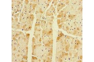 Immunohistochemistry of paraffin-embedded human heart tissue using ABIN7145063 at dilution of 1:100 (Corin 抗体  (AA 1-110))