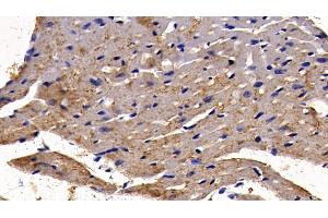 Detection of NFKB3 in Mouse Cardiac Muscle Tissue using Polyclonal Antibody to Transcription Factor P65 (NFKB3) (NF-kB p65 抗体  (AA 19-306))