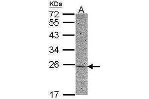 WB Image Sample (30 ug of whole cell lysate) A: HCT116 12% SDS PAGE antibody diluted at 1:500 (Adenylate Kinase 1 抗体)