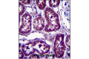 DPYS Antibody (C-term) (ABIN657357 and ABIN2846407) immunohistochemistry analysis in formalin fixed and paraffin embedded human kidney tissue followed by peroxidase conjugation of the secondary antibody and DAB staining. (DPYS 抗体  (C-Term))