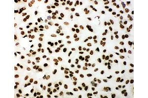 Immunohistochemistry (IHC) image for anti-Tumor Protein P53 Binding Protein 1 (TP53BP1) (AA 1955-1972), (C-Term) antibody (ABIN3044038)
