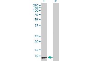 Western Blot analysis of CARD18 expression in transfected 293T cell line by CARD18 MaxPab polyclonal antibody. (CARD18 抗体  (AA 1-90))