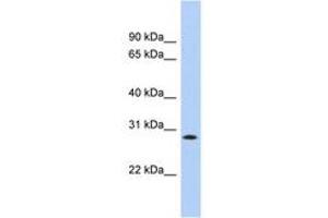 Image no. 1 for anti-Potassium Channel Tetramerisation Domain Containing 17 (KCTD17) (AA 179-228) antibody (ABIN6742565) (KCTD17 抗体  (AA 179-228))