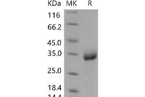 Western Blotting (WB) image for Chondrolectin (CHODL) protein (His tag) (ABIN7320184) (CHODL Protein (His tag))