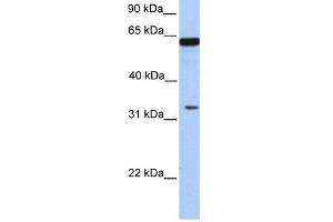 PERLD1 antibody used at 1 ug/ml to detect target protein. (PGAP3 抗体  (N-Term))