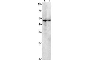 Western Blotting (WB) image for anti-Kruppel-Like Factor 5 (Intestinal) (KLF5) antibody (ABIN2426111)