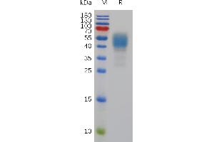 SDS-PAGE (SDS) image for Cannabinoid Receptor 1 (CNR1) (AA 1-118) protein (Fc Tag) (ABIN7491063)