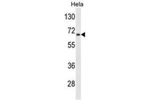 Western blot analysis of AGXT2 Antibody (C-term) in Hela cell line lysates (35 µg/lane). (AGXT2 抗体  (C-Term))