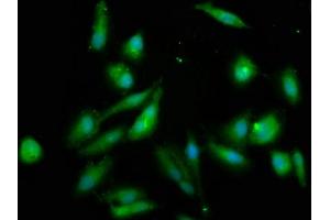 Immunofluorescence staining of Hela cells with ABIN7170786 at 1:133, counter-stained with DAPI.