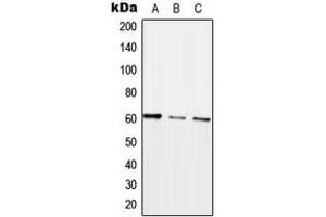 Western blot analysis of ARHGEF5 expression in HEK293T (A), SP2/0 (B), H9C2 (C) whole cell lysates. (ARHGEF5 抗体  (Center))