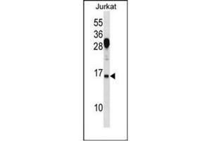 Western blot analysis of RhoG Antibody (C-term) in Jurkat cell line lysates (35ug/lane). (RHOG 抗体  (C-Term))