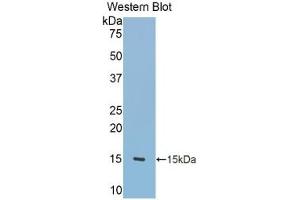Detection of Recombinant TNC, Rat using Polyclonal Antibody to Tenascin C (TNC) (TNC 抗体  (AA 513-621))