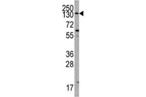 Western Blotting (WB) image for anti-Phosphoinositide-3-Kinase, Catalytic, alpha Polypeptide (PIK3CA) (AA 504-533) antibody (ABIN3028924)