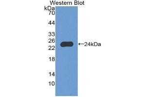Western blot analysis of the recombinant protein. (NCF2 抗体  (AA 355-526))