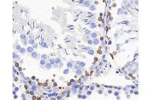 Immunohistochemistry analysis of paraffin-embedded rat testis using TSC22D3 Polyclonal Antibody at dilution of 1:300. (TSC22D3 抗体)