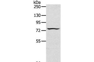 Western Blot analysis of Jurkat cell using TAP2 Polyclonal Antibody at dilution of 1:200 (TAP2 抗体)