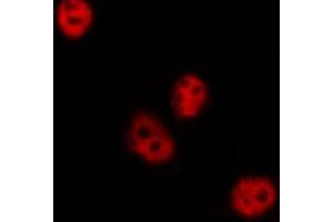 Immunofluorescence (fixed cells) (IF/ICC) image for anti-cAMP Responsive Element Binding Protein 1 (CREB1) (pSer142) antibody (ABIN6254981)