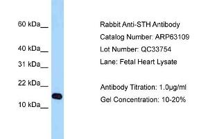 Western Blotting (WB) image for anti-Saitohin (STH) (Middle Region) antibody (ABIN2789376) (STH 抗体  (Middle Region))