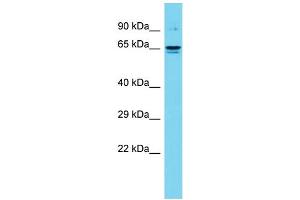 Host: Rabbit Target Name: DTX4 Sample Type: Fetal Kidney lysates Antibody Dilution: 1. (Deltex Homolog 4 抗体  (C-Term))