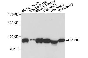 Western blot analysis of extracts of various cell lines, using CPT1C antibody. (CPT1C 抗体)