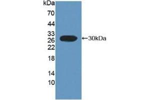Detection of Recombinant FcaR, Rat using Polyclonal Antibody to Fc Fragment Of IgA Receptor (FcaR) (FCAR 抗体  (AA 51-280))