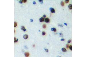 Immunohistochemical analysis of NRIP2 staining in human brain formalin fixed paraffin embedded tissue section. (NRIP2 抗体  (N-Term))