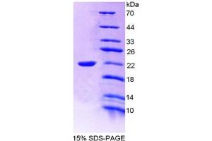 SDS-PAGE of Protein Standard from the Kit  (Highly purified E. (IL-19 ELISA 试剂盒)