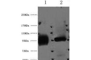 Western Blot analysis of 1) Hela, 2) 293T cells using ABCB5 Monoclonal Antibody at dilution of 1:2000. (ABCB5 抗体)