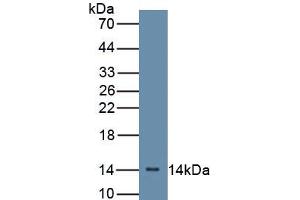 Detection of Recombinant CFB, Mouse using Polyclonal Antibody to Complement Factor B (CFB) (Complement Factor B 抗体  (AA 32-157))