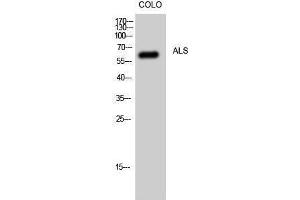 Western Blotting (WB) image for anti-Superoxide Dismutase 1, Soluble (SOD1) (Internal Region) antibody (ABIN3183256) (SOD1 抗体  (Internal Region))