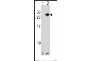 Western blot analysis of RCAN1 (arrow) using Calcipressin-1 Antibody . (RCAN1 抗体  (N-Term))